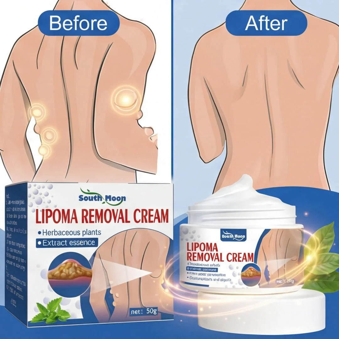 Lipoma Removal Cream (IMPORTED)