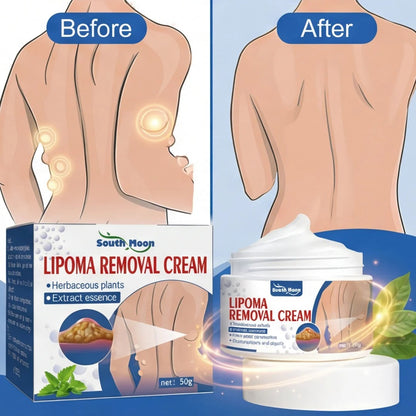 Lipoma Removal Cream (IMPORTED)